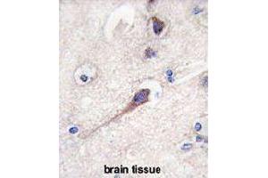 Formalin-fixed and paraffin-embedded human brain tissue reacted with HPCA polyclonal antibody  , which was peroxidase-conjugated to the secondary antibody, followed by DAB staining. (Hippocalcin anticorps  (N-Term))