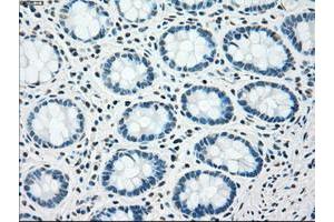 Image no. 4 for anti-Checkpoint Kinase 2 (CHEK2) antibody (ABIN1497498) (CHEK2 anticorps)