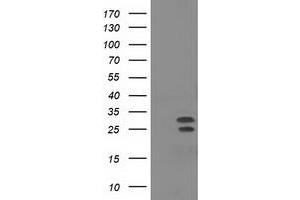 Western Blotting (WB) image for anti-Nonhomologous End-Joining Factor 1 (NHEJ1) antibody (ABIN1499730) (NHEJ1 anticorps)