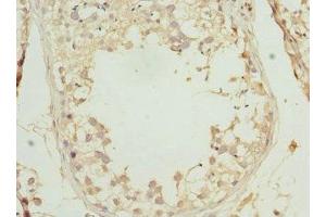 Immunohistochemistry of paraffin-embedded human testis tissue using ABIN7164276 at dilution of 1:100 (PRICKLE2 anticorps  (AA 615-844))