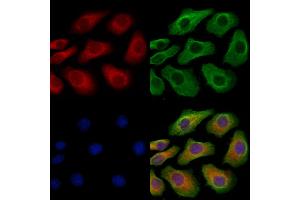 ABIN6265478 and ABIN6279868 staining Hela cells by IF/ICC. (TBC1D2 anticorps  (N-Term))