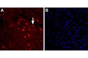 Expression of glycine transporter 2 in mouse brain stemImmunohistochemical staining of immersion-fixed, free floating mouse brain frozen sections using Anti-GlyT2 (SLC6A5) (extracellular) Antibody (ABIN7237858, ABIN7316615 and ABIN7316616), (1:200).