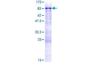 Image no. 1 for Achalasia, Adrenocortical Insufficiency, Alacrimia (AAAS) (AA 1-546) protein (GST tag) (ABIN1305377)
