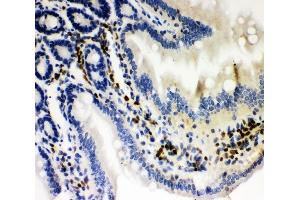 IHC analysis of RUNX3 using anti-RUNX3 antibody (ABIN3043318). (RUNX1 anticorps  (Middle Region))