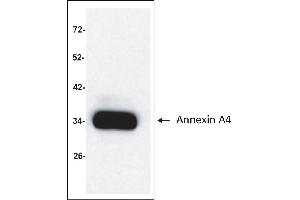 Antigen: Colo 205 cells lysate (Total protein per lane: 15 µg)  Primary Antibody: Anti-ANXA4 monoclonal (PA351-29.
