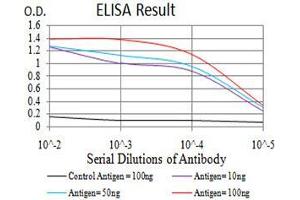 Black line: Control Antigen (100 ng),Purple line: Antigen (10 ng), Blue line: Antigen (50 ng), Red line:Antigen (100 ng)