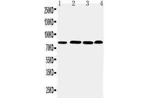 Anti-PROX1 antibody, Western blotting Lane 1: Rat Thymus Tissue Lysate Lane 2: HELA Cell Lysate Lane 3: JURKAT Cell Lysate Lane 4: MM231 Cell Lysate