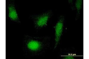 Immunofluorescence of monoclonal antibody to COPS2 on HeLa cell.