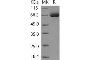 Western Blotting (WB) image for EPH Receptor B1 (EPHB1) (AA 565-984) (Active) protein (GST tag,His tag) (ABIN7317058)
