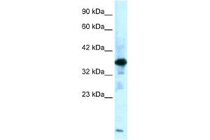 WB Suggested Anti-ZFPL1 Antibody Titration:  0. (ZFPL1 anticorps  (Middle Region))