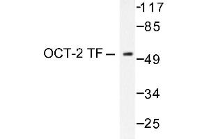 Image no. 1 for anti-POU domain, class 2, transcription factor 2 (POU2F2) antibody (ABIN271754) (Oct-2 anticorps)