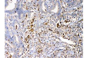 IHC analysis of Psoriasin using anti-Psoriasin antibody .