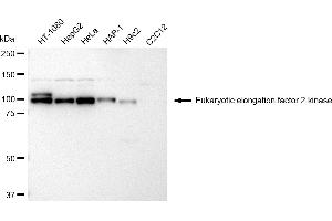 Western blotting analysis using Eukaryotic elongation factor 2 kinase antibody (ABIN7798497).