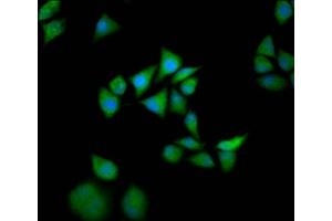 Immunofluorescence staining of Hela cells with ABIN7170318 at 1:133, counter-stained with DAPI. (SOS1 anticorps  (AA 1140-1281))