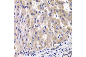Immunohistochemistry of paraffin-embedded rat liver using RPL14 antibody (ABIN5974063) at dilution of 1/100 (40x lens). (RPL14 anticorps)