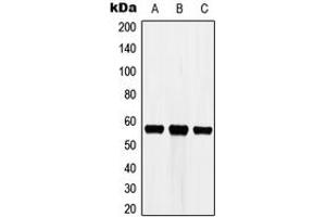 Western blot analysis of Cytochrome P450 3A7 expression in HEK293T (A), Raw264. (CYP3A7 anticorps  (Center))