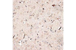 Immunohistochemistry of paraffin-embedded rat brain using KTN1 antibody. (KTN1 anticorps  (AA 1-100))