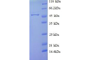 SDS-PAGE (SDS) image for Sulfite Oxidase (SUOX) (AA 1-416), (full length) protein (His tag) (ABIN5711821) (SUOX Protein (AA 1-416, full length) (His tag))