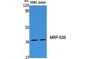 Western Blot (WB) analysis of specific cells using MRP-S35 Polyclonal Antibody. (MRPS35 anticorps  (Internal Region))