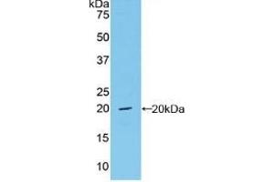 Detection of Recombinant vWF, Mouse using Polyclonal Antibody to Von Willebrand Factor (vWF)