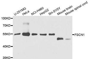 Western blot analysis of extracts of various cell lines, using FSCN1 antibody.