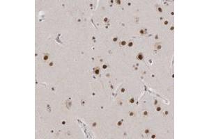 Immunohistochemical staining of human cerebral cortex with CXorf23 polyclonal antibody  shows strong nuclear positivity in neuronal cells. (CXORF23 anticorps)