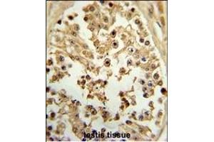 Formalin-fixed and paraffin-embedded human testis tissue reacted with EIF4E Antibody (ABIN650675 and ABIN2838634) , which was peroxidase-conjugated to the secondary antibody, followed by DAB staining.