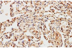 Immunohistochemistry of paraffin-embedded Human lung using IMP3 Polyclonal Antibody at dilution of 1:200 (IMP3 anticorps)