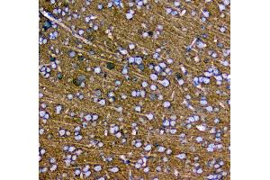 IHC analysis of Synaptotagmin 1 using anti-Synaptotagmin 1 antibody .