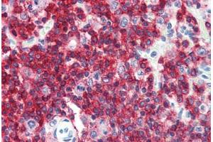 Anti-CD45RA antibody IHC staining of human spleen. (CD45RA anticorps  (FITC))