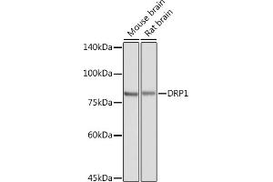 Western blot analysis of extracts of various cell lines, using DRP1 Rabbit pAb (ABIN3023669, ABIN3023670, ABIN3023671, ABIN1679564 and ABIN6219696) at 1:8000 dilution.