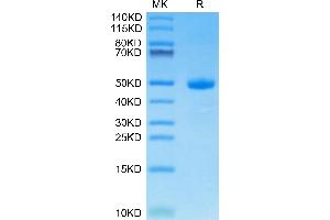 Human CDH17 Domain 7 on Tris-Bis PAGE under reduced condition. (LI Cadherin Protein (AA 668-777) (Fc Tag))