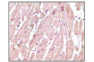 Immunohistochemical analysis of paraffin-embedded human normal cardiac muscle tissue, showing cytoplasmic localization using cTnI antibody with DAB staining. (TNNI3 anticorps)
