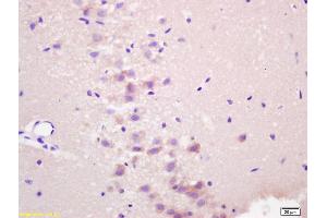 Formalin-fixed and paraffin embedded rat brain labeled with Anti-RASSF1A Polyclonal Antibody, Unconjugated (ABIN673764) at 1:200 followed by conjugation to the secondary antibody and DAB staining.
