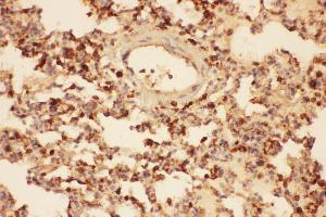 Anti-Cofilin Picoband antibody,  IHC(P): Rat Lung Tissue