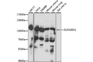 Western blot analysis of extracts of various cell lines, using SUV420H1 antibody (ABIN7270648) at 1:1000 dilution.