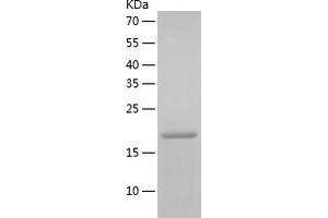 Western Blotting (WB) image for Ras Homolog Gene Family, Member C (RHOC) (AA 1-190) protein (His-IF2DI Tag) (ABIN7124787)