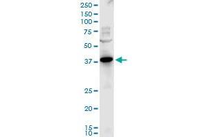 PXMP3 polyclonal antibody (A01), Lot # 051031JC01.