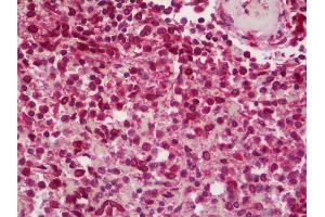 Anti-BCAR1 / p130Cas antibody IHC staining of human spleen. (BCAR1 anticorps  (AA 275-325))