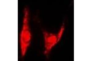 Immunofluorescent analysis of PSMD8 staining in U2OS cells. (PSMD8 anticorps)