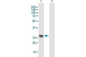 Western Blot analysis of C1QA expression in transfected 293T cell line by C1QA MaxPab polyclonal antibody.
