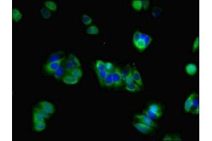 Immunofluorescent analysis of HepG2 cells using ABIN7153987 at dilution of 1:100 and Alexa Fluor 488-congugated AffiniPure Goat Anti-Rabbit IgG(H+L) (NMDAR2A anticorps  (AA 501-750))
