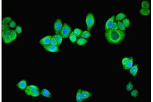 Immunofluorescent analysis of PC-3 cells using ABIN7164305 at dilution of 1:100 and Alexa Fluor 488-congugated AffiniPure Goat Anti-Rabbit IgG(H+L)