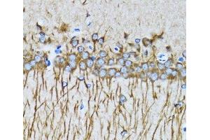 Immunohistochemistry of paraffin-embedded Mouse brain using MAP1LC3A Polyclonal Antibody at dilution of 1:100 (40x lens).