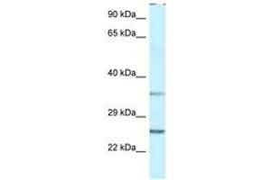 Image no. 1 for anti-Protein Phosphatase 1, Regulatory (Inhibitor) Subunit 2 (PPP1R2) (AA 27-76) antibody (ABIN6747489)