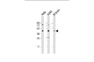 All lanes : Anti-G6PC3 Antibody (C-Term) at 1:1000 dilution Lane 1: Hela whole cell lysate Lane 2: A549 whole cell lysate Lane 3: mouse brain lysate Lysates/proteins at 20 μg per lane. (G6PC3 anticorps  (AA 215-246))