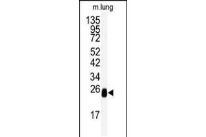 Western blot analysis of anti-DCXR Antibody in mouse lung tissue lysates (35ug/lane)