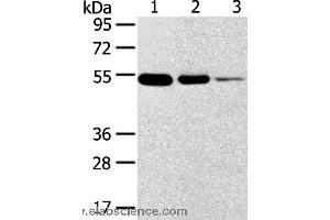 Western blot analysis of Human thyroid and esophagus cancer, human normal rectum tissue, using TMPRSS11F Polyclonal Antibody at dilution of 1:500 (TMPRSS11F anticorps)