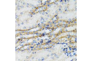 Immunohistochemistry of paraffin-embedded mouse kidney using SERPING1 antibody (ABIN6290125) at dilution of 1:100 (40x lens). (SERPING1 anticorps)