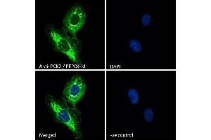 (ABIN185483) Immunofluorescence analysis of paraformaldehyde fixed U2OS cells, permeabilized with 0. (PEPCK anticorps  (Internal Region))